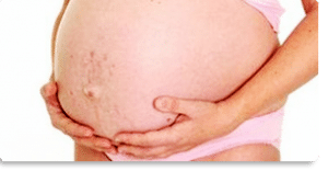 fiori di bach in gravidanza smagliature