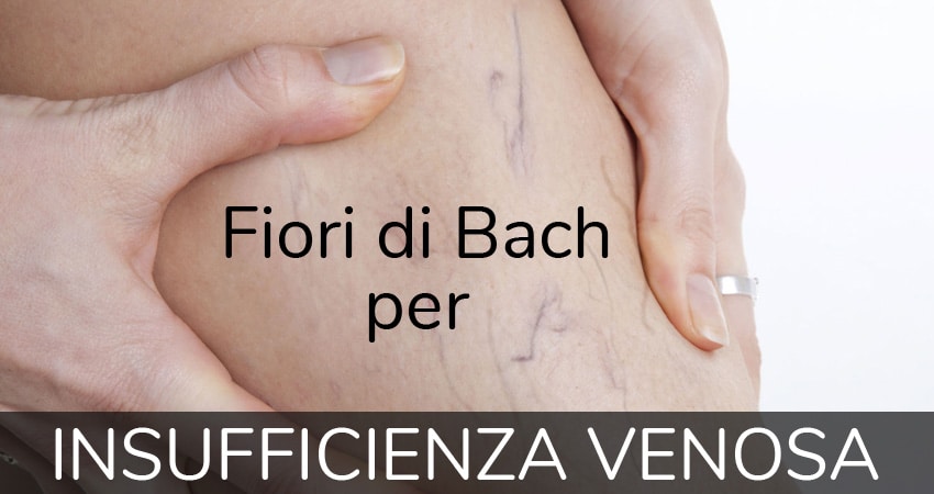 fiori di Bach per insufficienza venosa