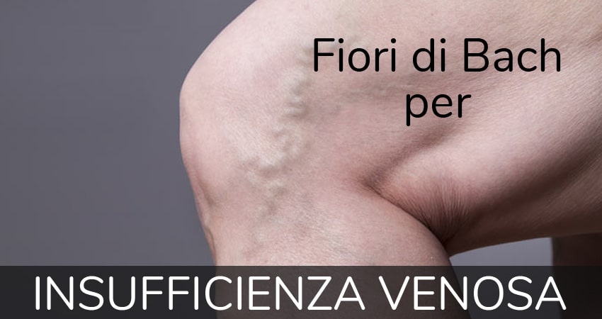 fiori di Bach per insufficienza venosa
